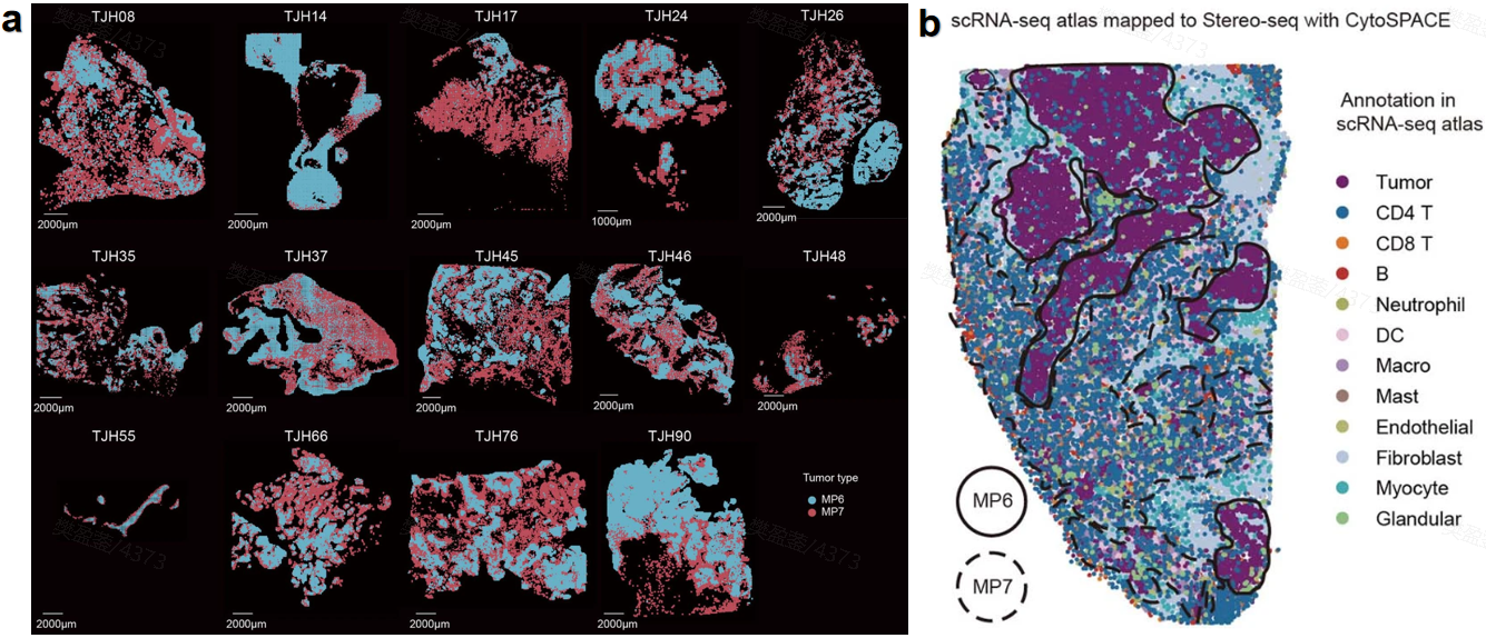 Figure 2. (a) Use Stereo-seq to detect the spatial distribution of tumor spots in several slices. (b) Different MP6 and MP7 regions are presented by mapping onto a Stereo-seq map.